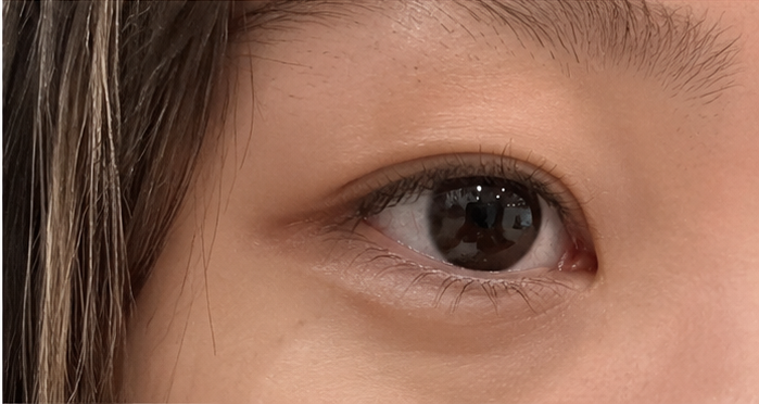 Eye Detail