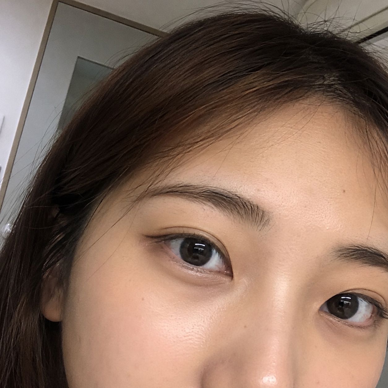 Front View Result