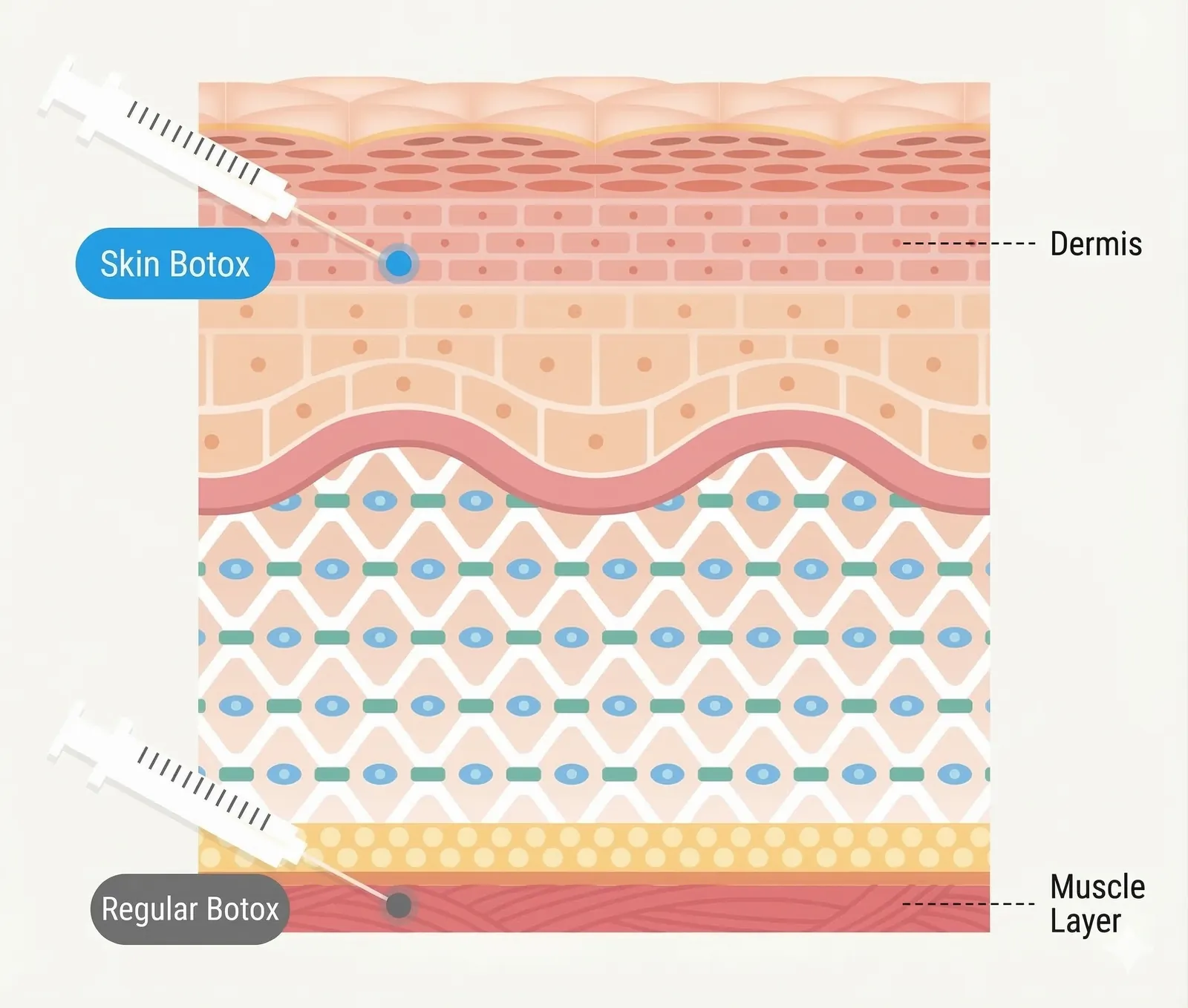 Botox and Filler Treatments